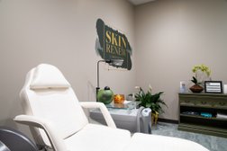 Skin Renew Day Spa & Laser Center in Indianapolis