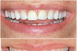 Advanced Cosmetic & Implant Dentistry | Kevin Landers DDS FAACD in Chicago